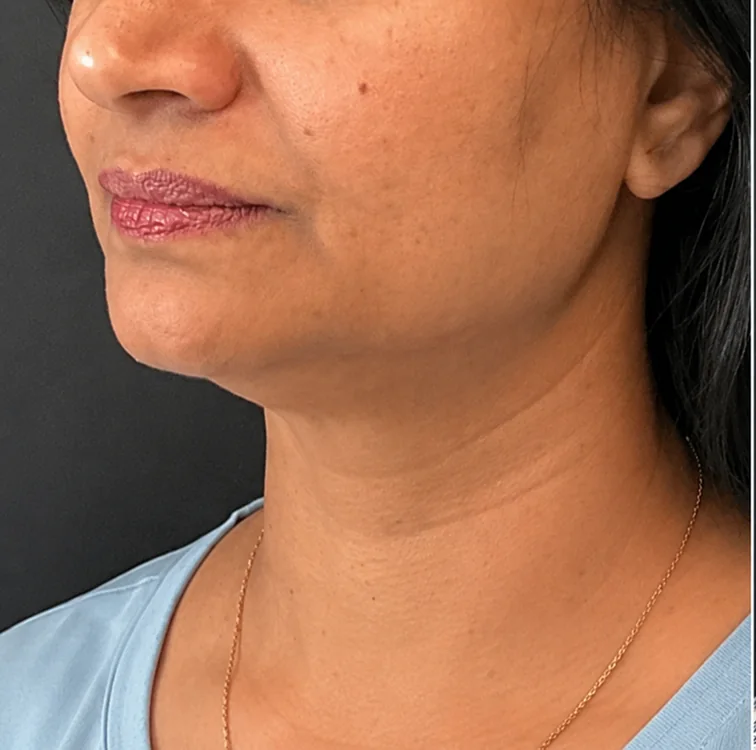 Neck, Before