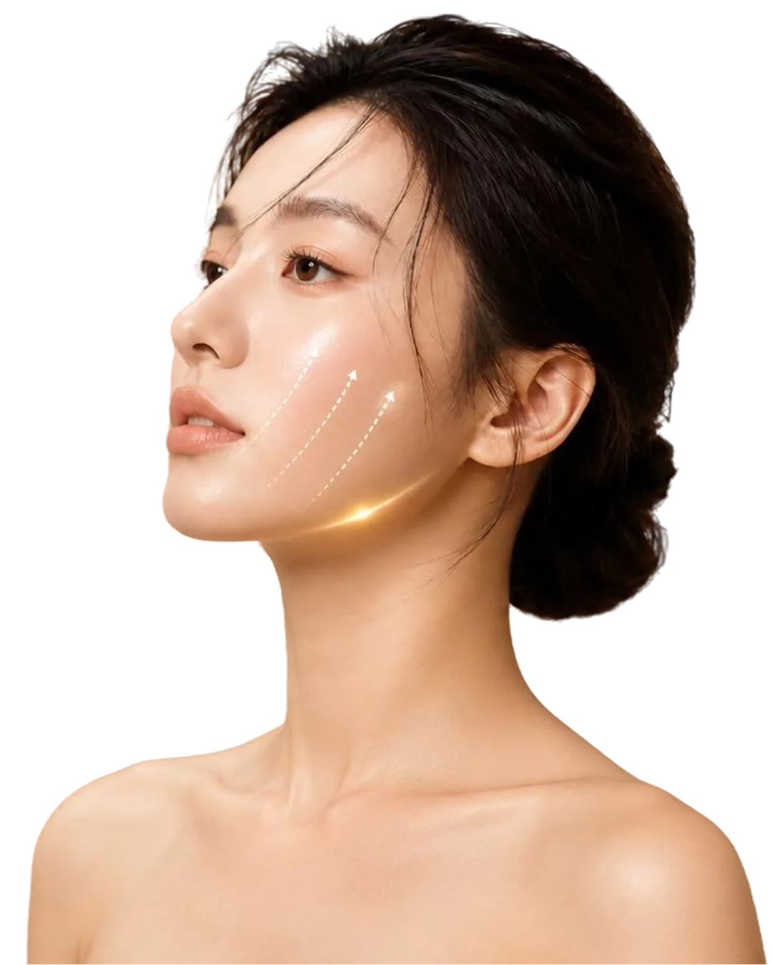 Profile of a woman with the XERF treatment areas marked